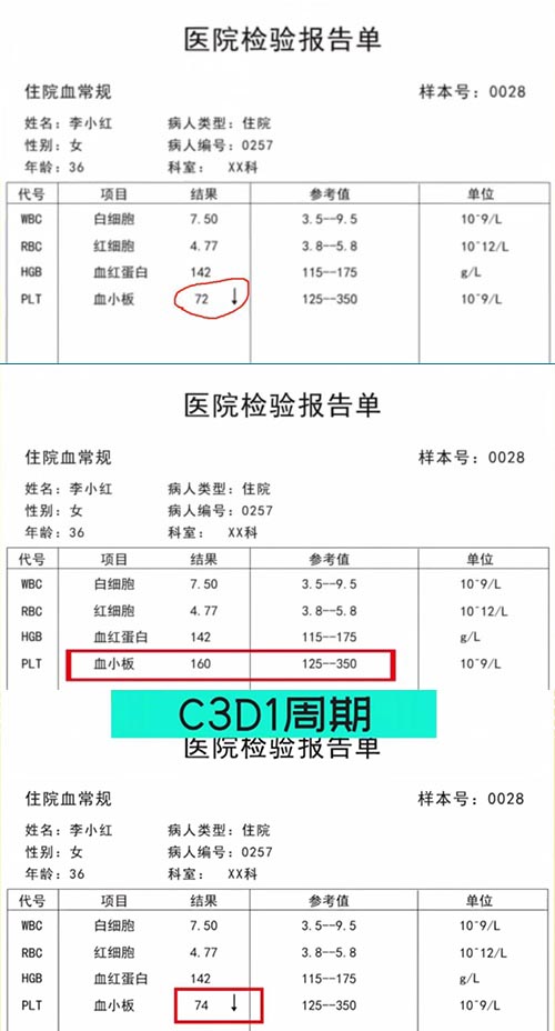 AE與研究藥物關(guān)系記錄不一致，如何處理？